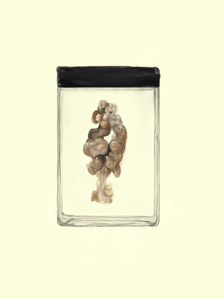 Audio exhibition | OVERTEXTED – Literature as Intermedial Practice